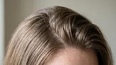 Hiukset rasvoittuvat nopeasti: miksi näin käy ja mitä asialle voi tehdä?