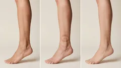 Ei turvotusta: Täydellinen turvotusta ehkäisevä rutiinini, joka auttaa minua aina